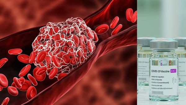 Studie FDA: Vakcína COVID je spojena se srážlivostí krve u starších osob